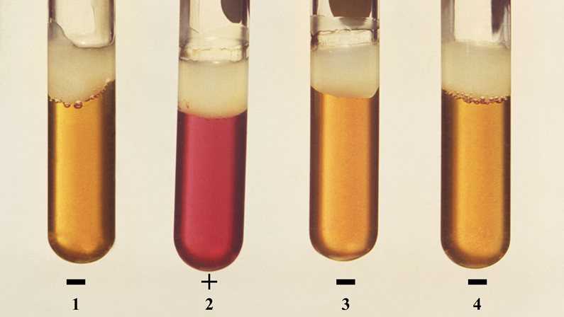 4 test tubes marked 1 to 4, 3 are yellow with - marks next to them, one is red with a + mark next to it